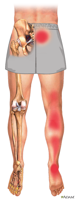 pain relief class, online class to relieve pain in hip and leg
