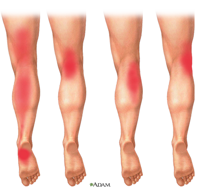 pain relief class, online class to relieve foot and calf