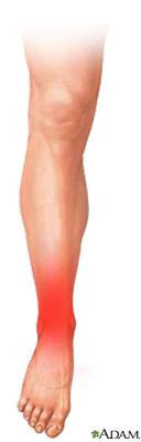 ankle, pain relief class, online class to relieve ankle pain