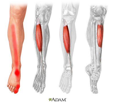  Tibialis Anterior 